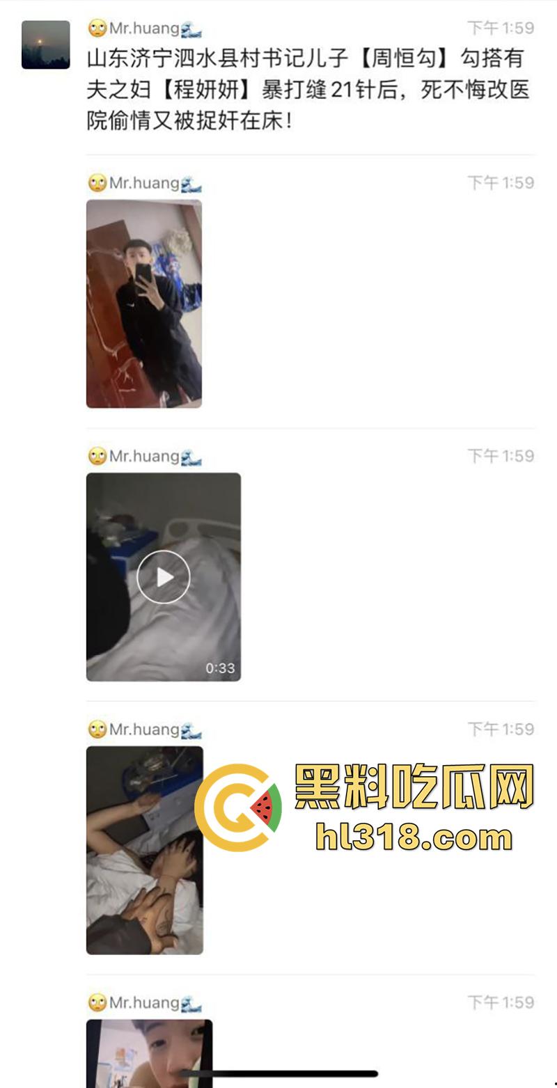 山东济宁泗水县书记儿子【周恒勾】,勾搭撩骚有夫之妇【程妍妍】,被夫家暴打缝21针,竟再次医院偷情 !-1