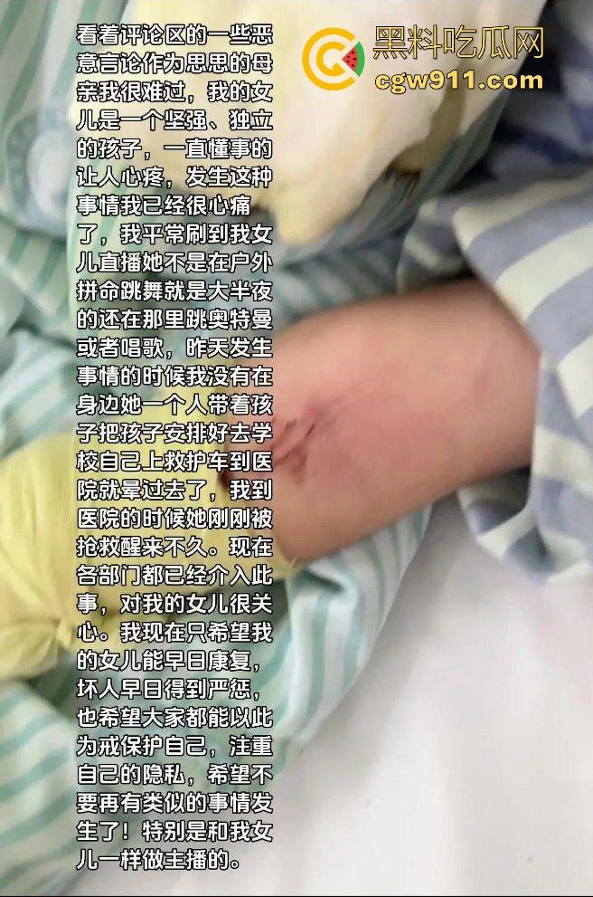 湖南性感擦边主播遭疯狂粉丝寄炸弹包裹炸伤,粉丝疯狂起来真恐怖啊,好端端的性感主播炸成了隔壁大妈!-8