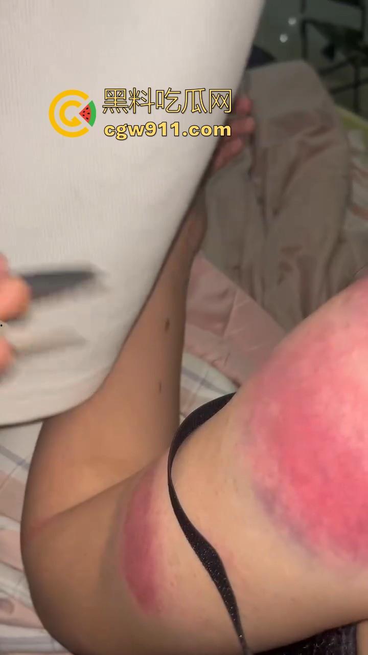 广西精神出租房围殴霸凌敌对小太妹,棍棒齐上,拳打脚踢,脱下衣服伤痕累累,战斗力丝毫不输男的!-9