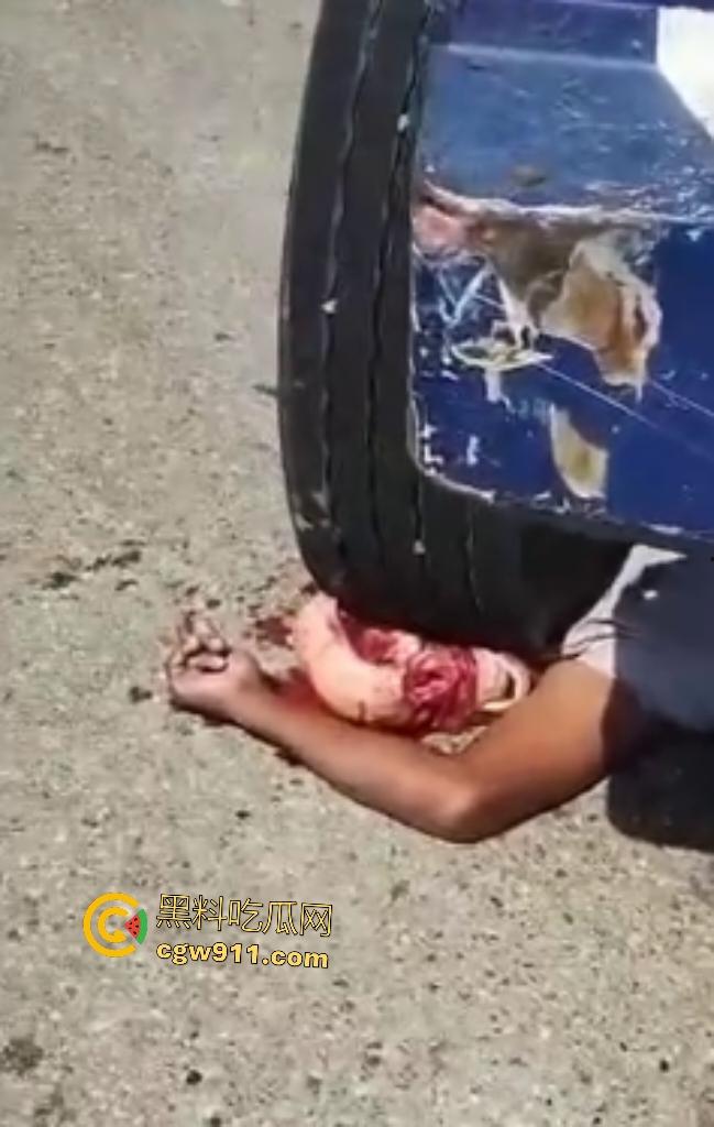 印尼摩托狂飙遭碾压!脑袋头皮刮飞露白骨,摩托吱吱狂响,车祸现场震碎人心,这还能救活吗?-3