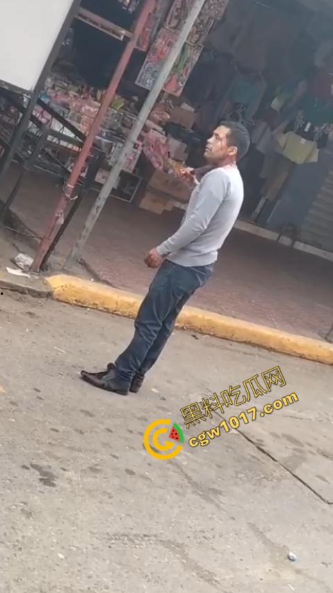 国外男子竟当街自残,刀割喉咙鲜血四溅,群众惊恐围观,男子倒地不省人事,惨烈一幕令人心悸胆战!-6